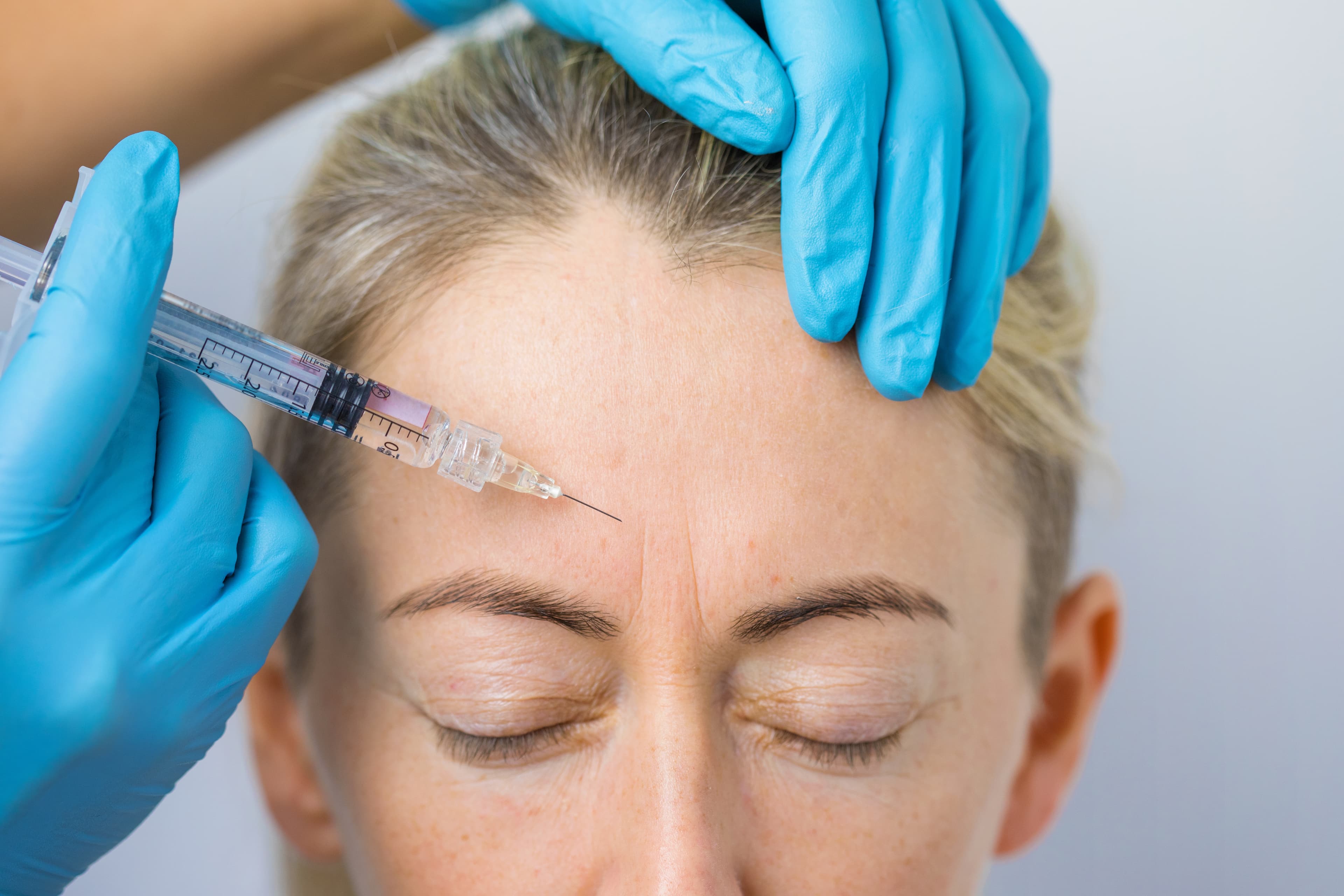 Botox + Neurotoxins