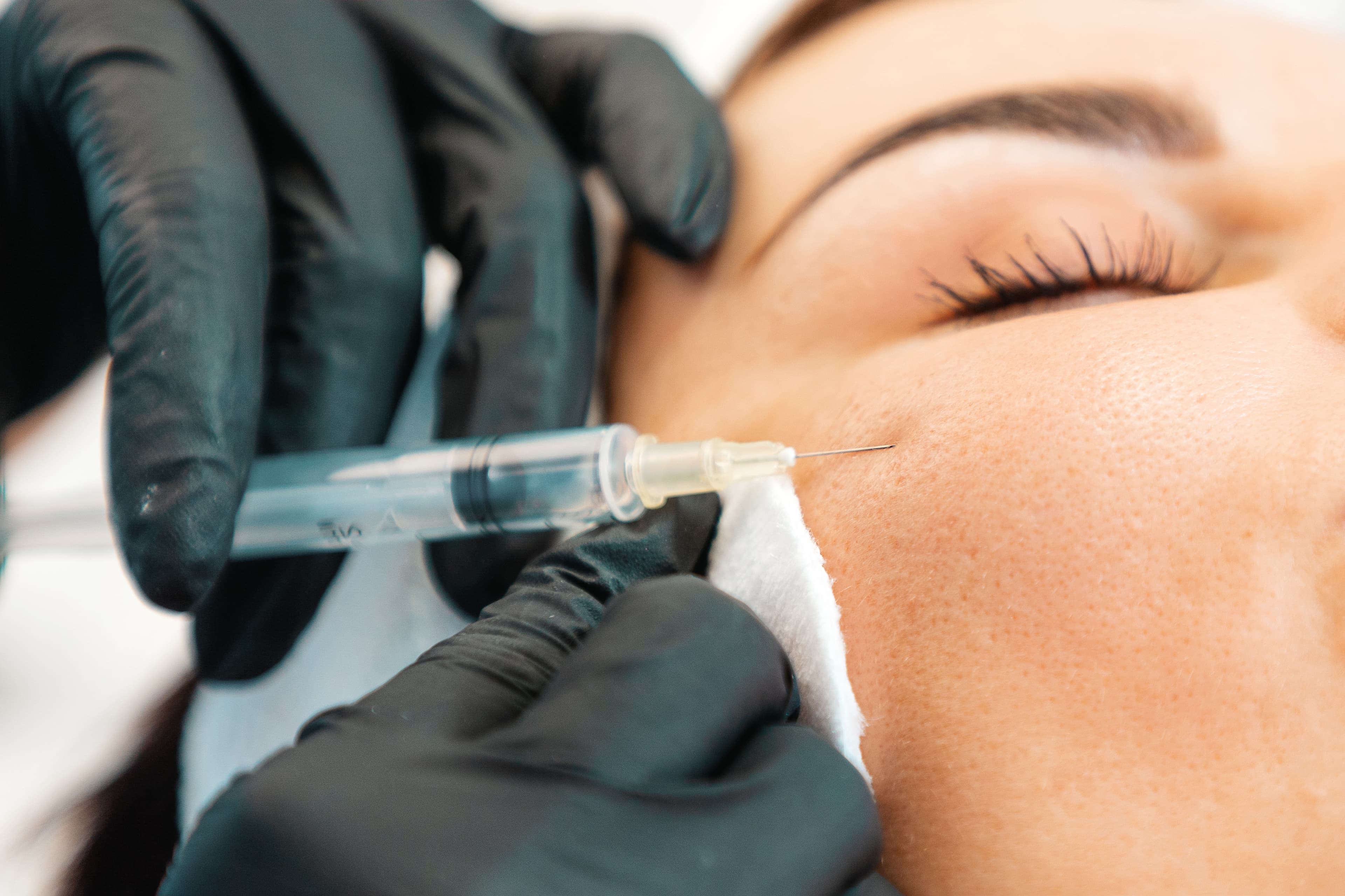 Dermal Fillers