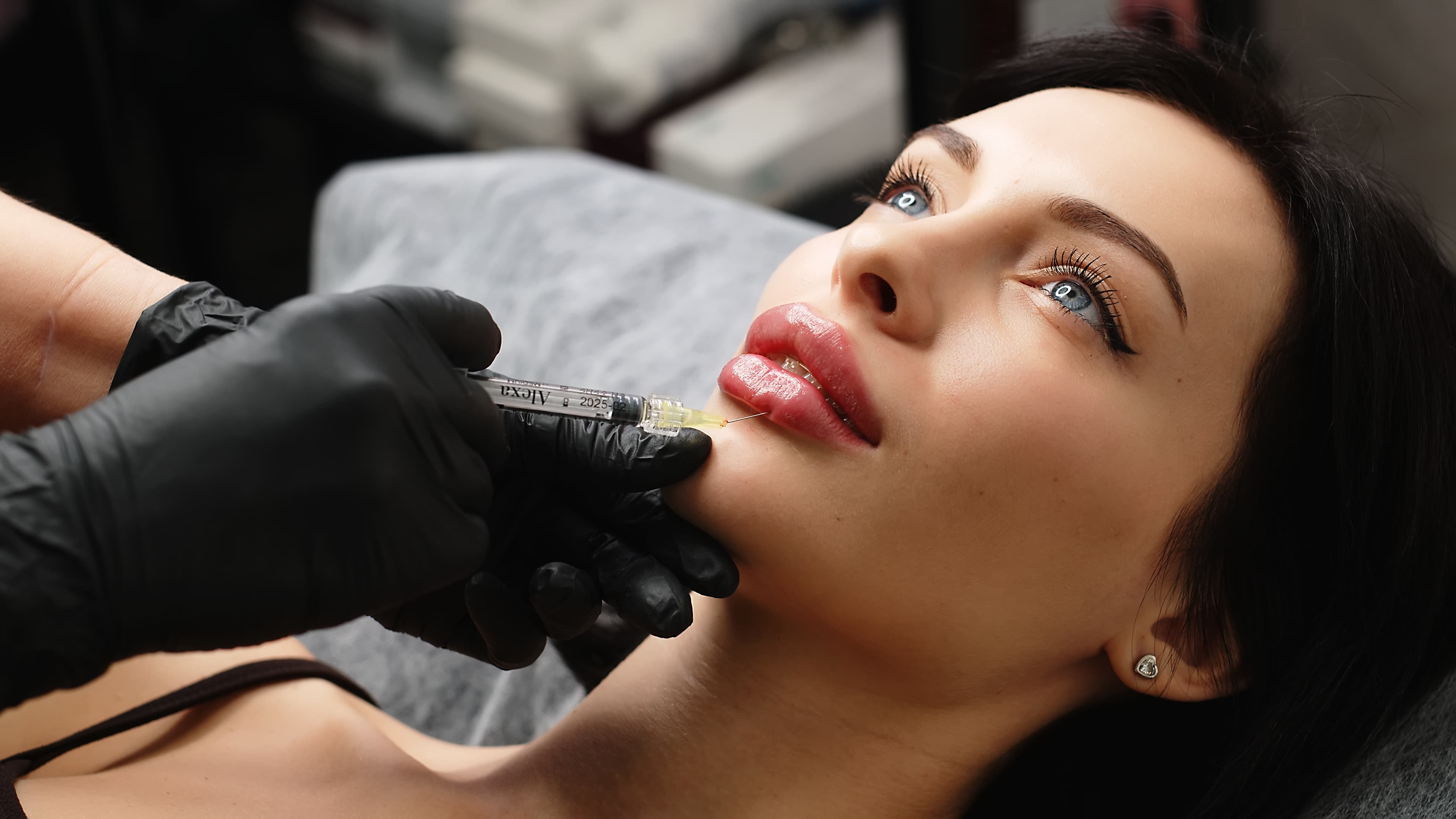 Lip Filler
